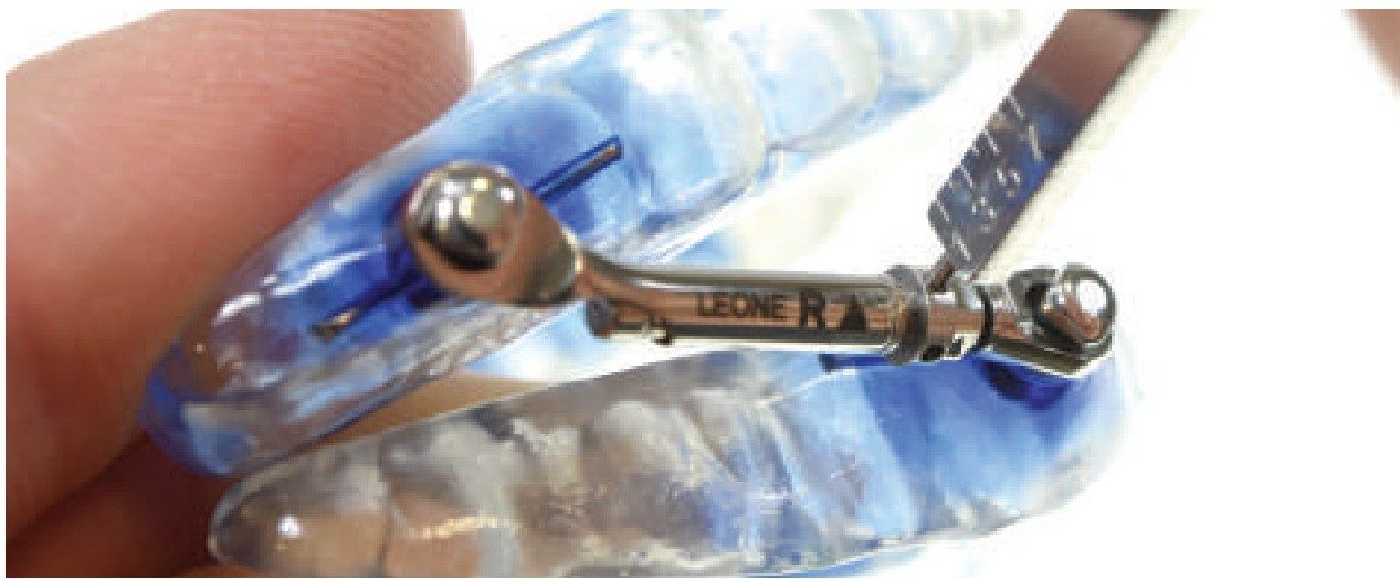 The Dual wrench engages the square head of the advancer screw